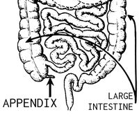 appendix - blinde darmontsteking